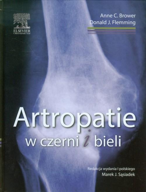 

Artropatie w czerni i bieli Brower Anne C., Flemmi