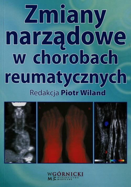 

Zmiany narządowe w chorobach... P.Wiland