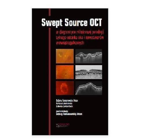 

Swept Source Oct w diagnostyce patologii tylnego b