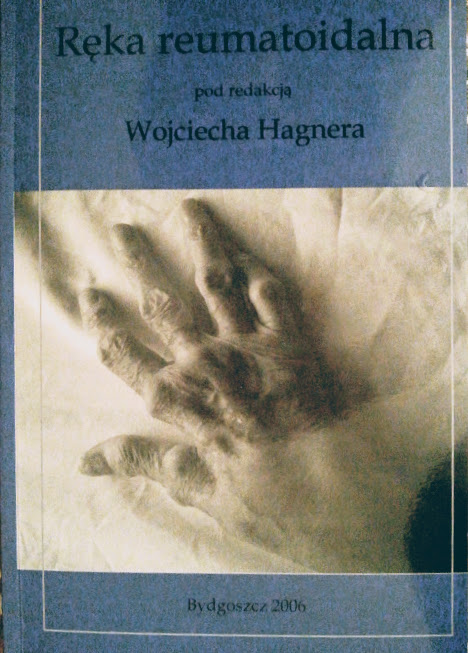 Ręka reumatoidalna Hagner fizjoterapia reumatyzm!