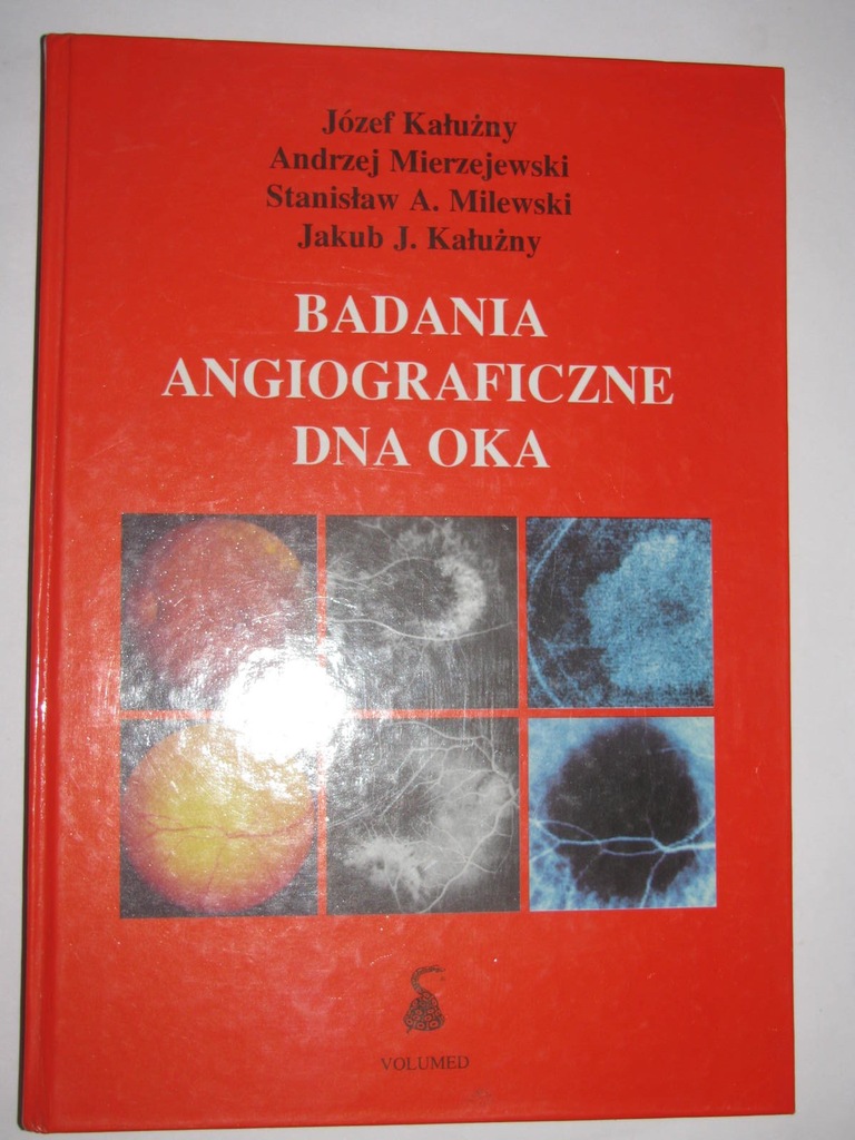 BADANIE ANGIOGRAFICZNE DNA OKA - KAŁUŻNY