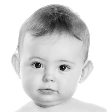 Otostick Baby Коррекция разделения ушей у ребенка