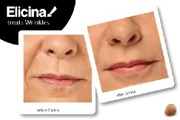 ELICINA крем для слизи улитки SCAR ACNE + СЫВОРОТКА