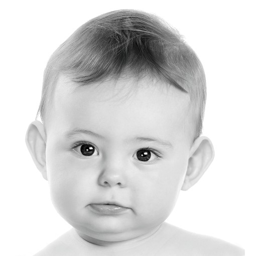Otostick Baby Коррекция разделения ушей у ребенка